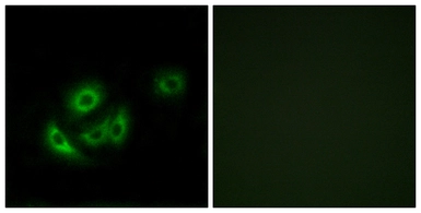 Anti-MRPL11 antibody used in Immunocytochemistry/ Immunofluorescence (ICC/IF). GTX87823