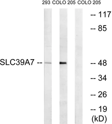 Anti-SLC39A7 antibody used in Western Blot (WB). GTX87830