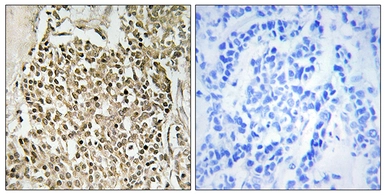 Anti-CEP350 antibody used in IHC (Paraffin sections) (IHC-P). GTX87833