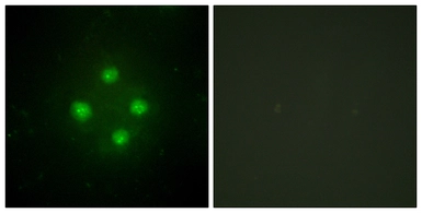 Anti-MED24 antibody used in Immunocytochemistry/ Immunofluorescence (ICC/IF). GTX87850