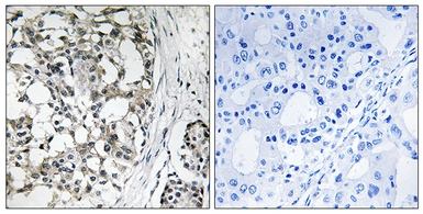 Anti-PEX14 antibody used in IHC (Paraffin sections) (IHC-P). GTX87875