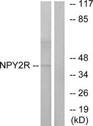 Anti-NPY2R antibody used in Western Blot (WB). GTX87927