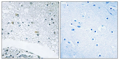 Anti-LAMC3 antibody used in IHC (Paraffin sections) (IHC-P). GTX87972