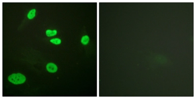 Anti-Histone H3K9ac (Acetyl Lys9) antibody used in Immunocytochemistry/ Immunofluorescence (ICC/IF). GTX88007