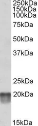 Anti-NDUFS7 antibody, Internal used in Western Blot (WB). GTX88036