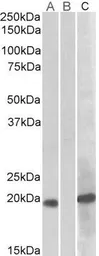 Anti-HOXA1 antibody, Internal used in Western Blot (WB). GTX88041