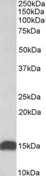 Anti-NDUFS6 antibody, Internal used in Western Blot (WB). GTX88043