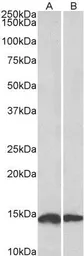 Anti-NDUFS6 antibody, Internal used in Western Blot (WB). GTX88043