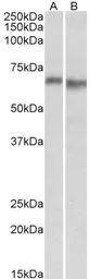 Anti-AMPK alpha 2 antibody, Internal used in Western Blot (WB). GTX88046