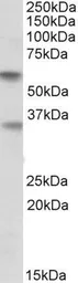Anti-SIGLEC6 antibody, Internal used in Western Blot (WB). GTX88051