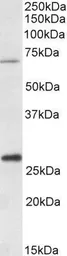 Anti-CPT2 (aa141-154) antibody, Internal used in Western Blot (WB). GTX88067