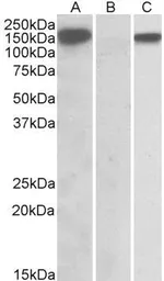Anti-NALP2 antibody, C-term used in Western Blot (WB). GTX88068