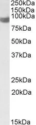 Anti-PLA2G4A antibody, Internal used in Western Blot (WB). GTX88072