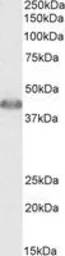 Anti-ACAT1 (aa257-269) antibody, Internal used in Western Blot (WB). GTX88076