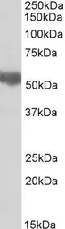 Anti-ALDH3A2 antibody, Internal used in Western Blot (WB). GTX88083