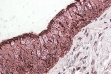 Anti-ALDH3A1 antibody, C-term used in IHC (Paraffin sections) (IHC-P). GTX88085