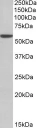 Anti-ALDH3A1 antibody, C-term used in Western Blot (WB). GTX88085