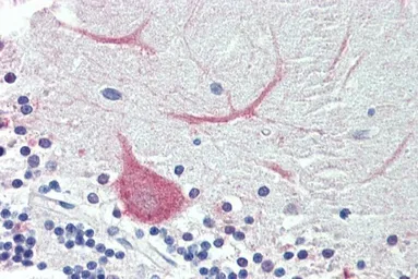 Anti-TRIM71 (aa390-402) antibody, Internal used in IHC (Paraffin sections) (IHC-P). GTX88128
