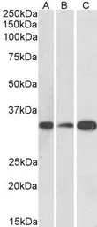 Anti-EB3 (aa151-164) antibody, Internal used in Western Blot (WB). GTX88134