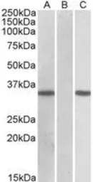 Anti-CRISP2 (aa77-89) antibody, Internal used in Western Blot (WB). GTX88144