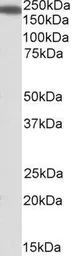 Anti-IQGAP1 antibody, Internal used in Western Blot (WB). GTX88153