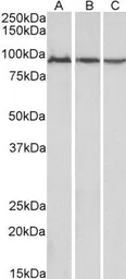 Anti-Aconitase 2 antibody, Internal used in Western Blot (WB). GTX88183