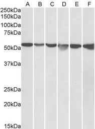Anti-GPI antibody, Internal (near N-term) used in Western Blot (WB). GTX88240