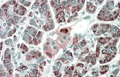 Anti-PEBP4 antibody, C-term used in IHC (Paraffin sections) (IHC-P). GTX88268