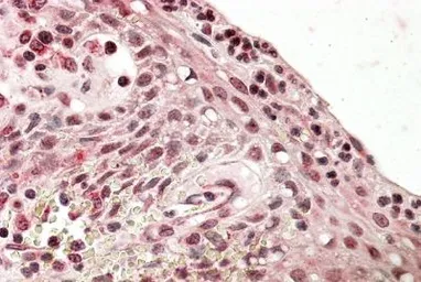 Anti-Blimp1 antibody, Internal used in IHC (Paraffin sections) (IHC-P). GTX88296