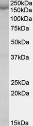 Anti-SA2 antibody, Internal used in Western Blot (WB). GTX88304