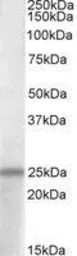 Anti-PACAP antibody, C-term used in Western Blot (WB). GTX88313
