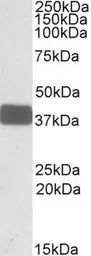 Anti-Wnt9b antibody, Internal used in Western Blot (WB). GTX88330