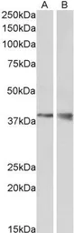 Anti-Wnt9b antibody, Internal used in Western Blot (WB). GTX88330