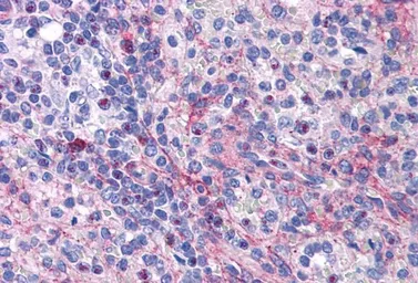 Anti-eIF5A antibody, Internal (near N-term) used in IHC (Paraffin sections) (IHC-P). GTX88355