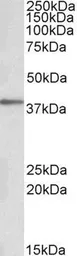 Anti-PRKCDBP antibody, Internal used in Western Blot (WB). GTX88367