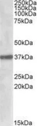 Anti-SUMF1 antibody, Internal used in Western Blot (WB). GTX88370