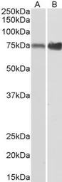 Anti-XPNPEP1 antibody, C-term used in Western Blot (WB). GTX88401
