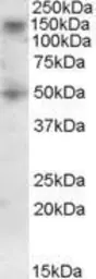 Anti-TRC8 antibody, C-term used in Western Blot (WB). GTX88450
