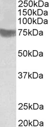 Anti-TRC8 antibody, C-term used in Western Blot (WB). GTX88450