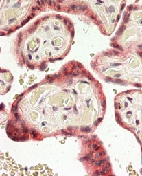 Anti-TRC8 antibody, C-term used in IHC (Paraffin sections) (IHC-P). GTX88450