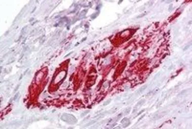 Anti-ITM2B antibody, Internal used in IHC (Paraffin sections) (IHC-P). GTX88466