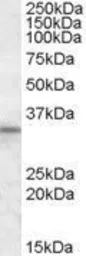 Anti-HAX1 antibody, Internal used in Western Blot (WB). GTX88468