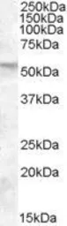 Anti-FKBP4 antibody, C-term used in Western Blot (WB). GTX88487