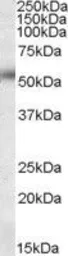 Anti-Orai1 antibody, Internal used in Western Blot (WB). GTX88489