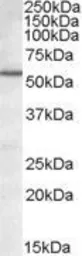 Anti-BAG5 antibody, Internal used in Western Blot (WB). GTX88490