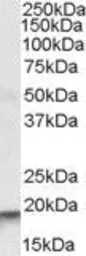 Anti-ARPC4 antibody, Internal used in Western Blot (WB). GTX88495