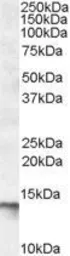 Anti-C1D antibody, C-term used in Western Blot (WB). GTX88500