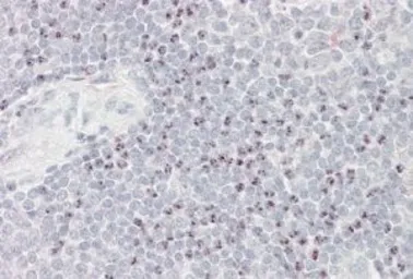 Anti-BAT3 antibody, Internal used in IHC (Paraffin sections) (IHC-P). GTX88511