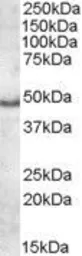 Anti-Apolipoprotein L5 antibody, C-term used in Western Blot (WB). GTX88519