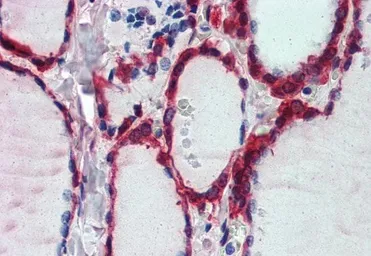 Anti-PRX I antibody, Internal used in IHC (Paraffin sections) (IHC-P). GTX88526